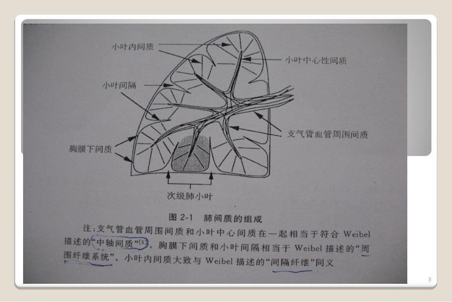 肺特殊CT征象ppt课件_第3页