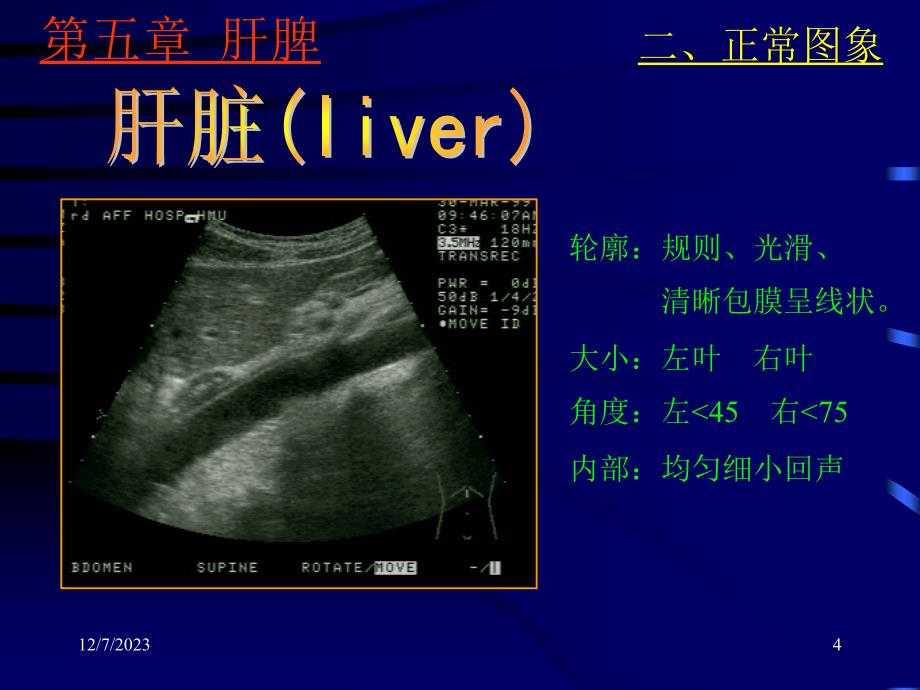 肝脏疾病的诊断一、正常声像图（了解）肝——形态立体楔形位置右季肋部_第4页