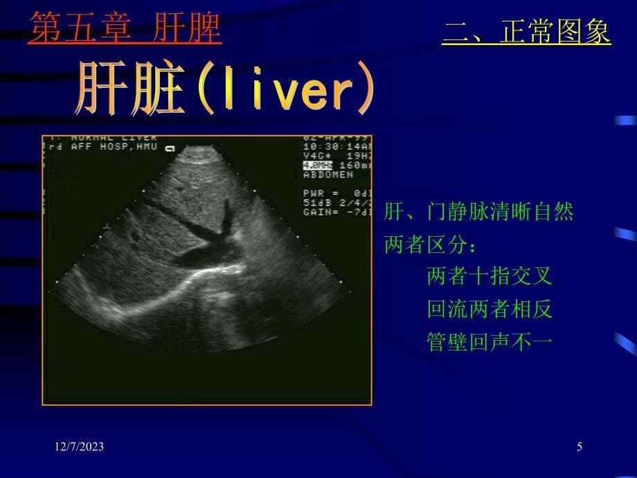 肝脏疾病的诊断一、正常声像图（了解）肝——形态立体楔形位置右季肋部_第5页