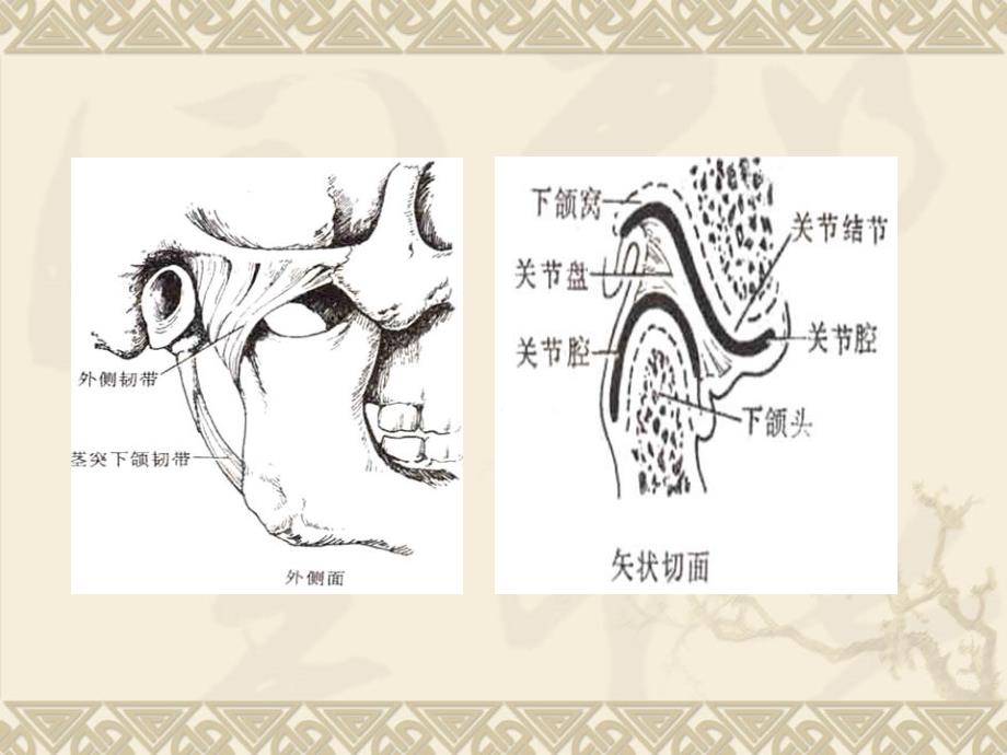 骨伤科护理学之关节脱位三_颞颌关节脱位_第4页