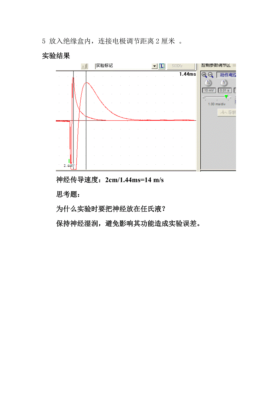 神经干传导速度的测量_第2页