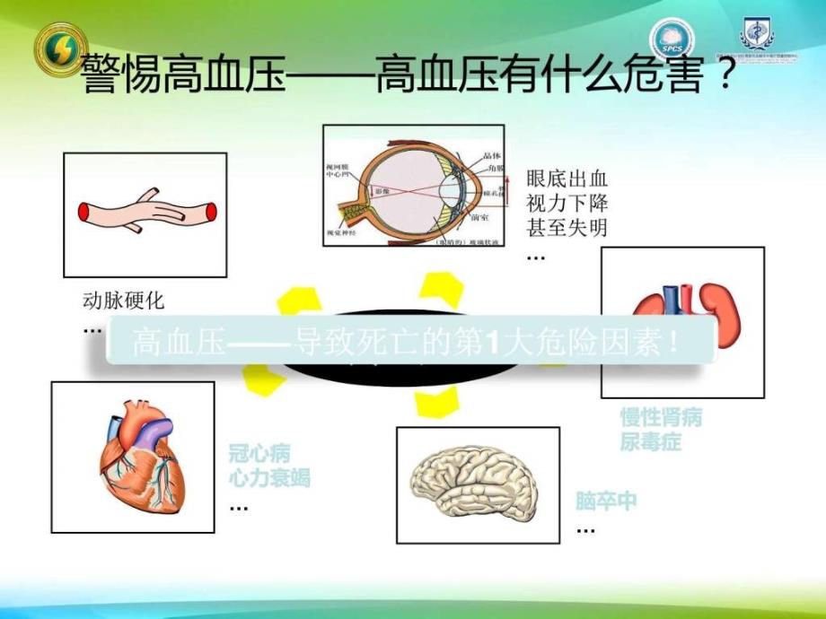 健康教育课堂心内科血压ppt课件_第2页