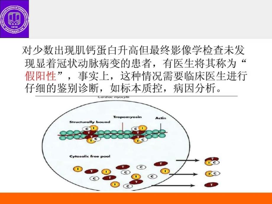 肌钙蛋白升高的鉴别诊断机械仪表工程科技专业资料ppt课件_第3页