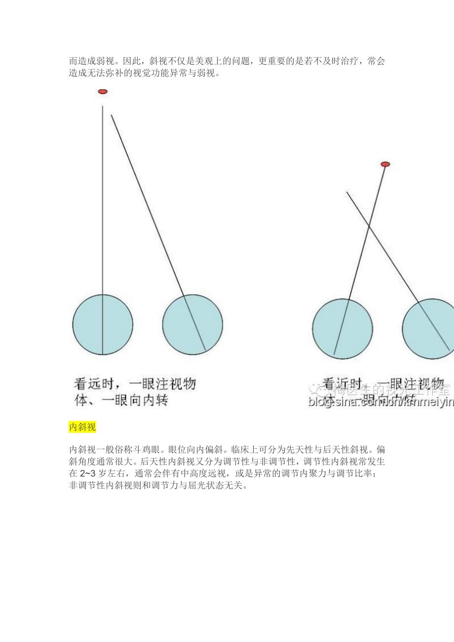 【视光】斜视、隐斜视与验光配镜的关系_第2页