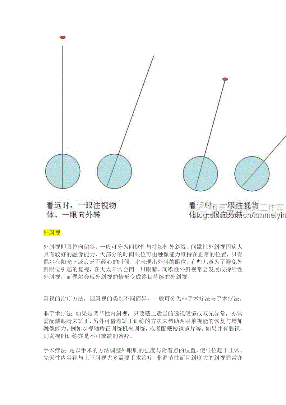 【视光】斜视、隐斜视与验光配镜的关系_第3页