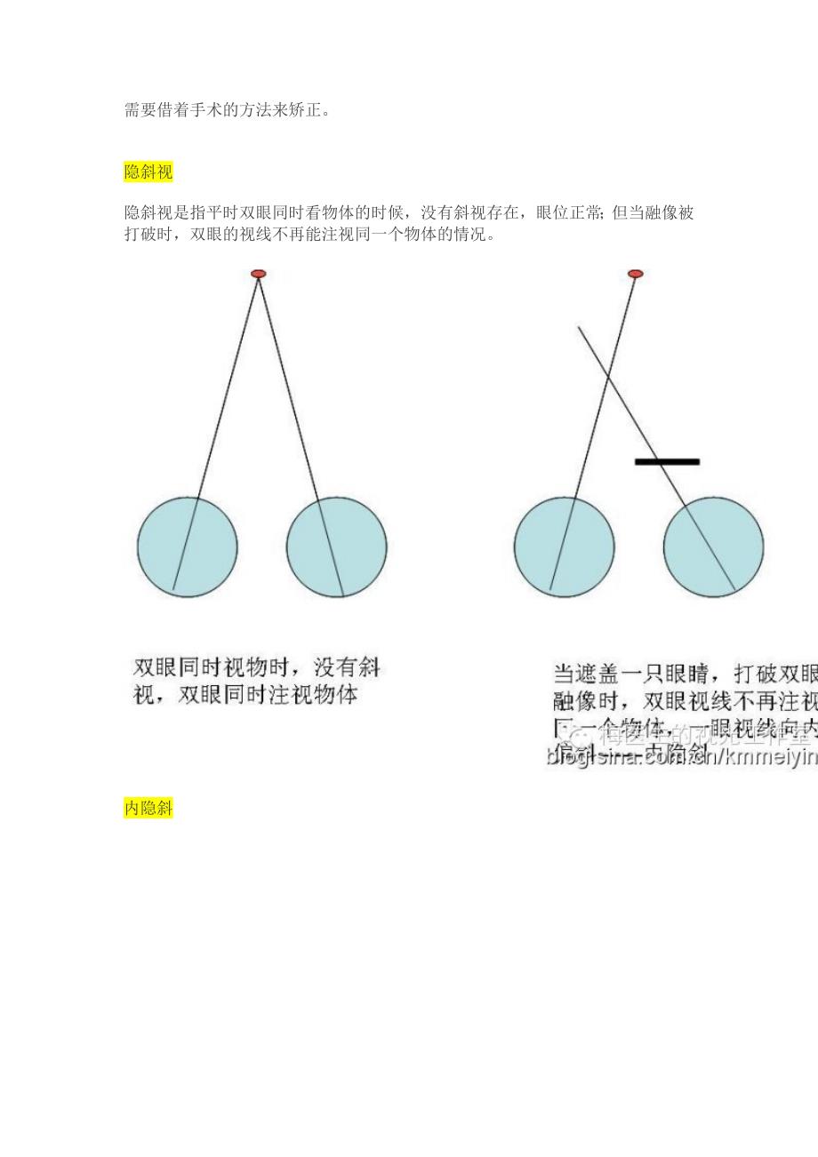 【视光】斜视、隐斜视与验光配镜的关系_第4页