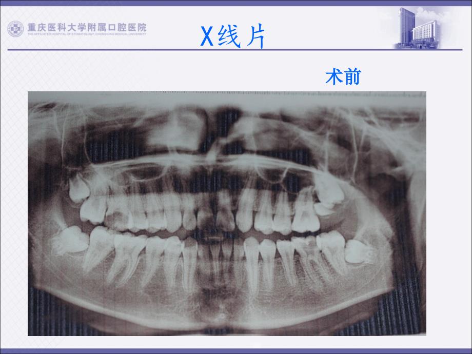 2015年5月牙体牙髓病例_第3页