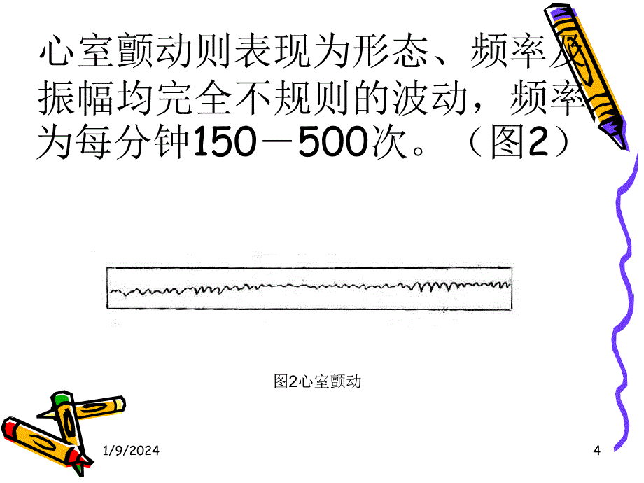 心脏电复律(电击_第4页