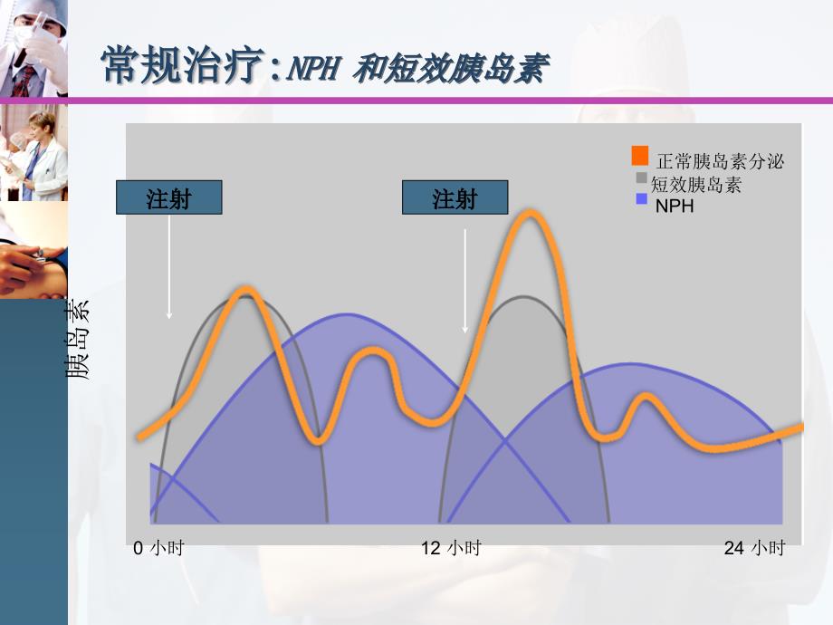 很好的胰岛素泵治疗知识ppt课件_第4页