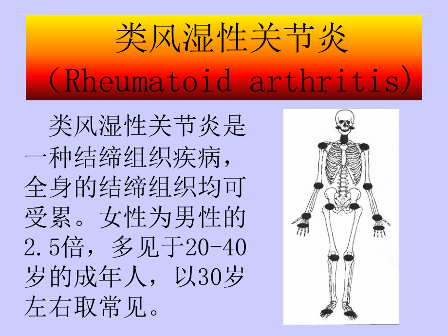 关节疾病（医学课件）_第2页