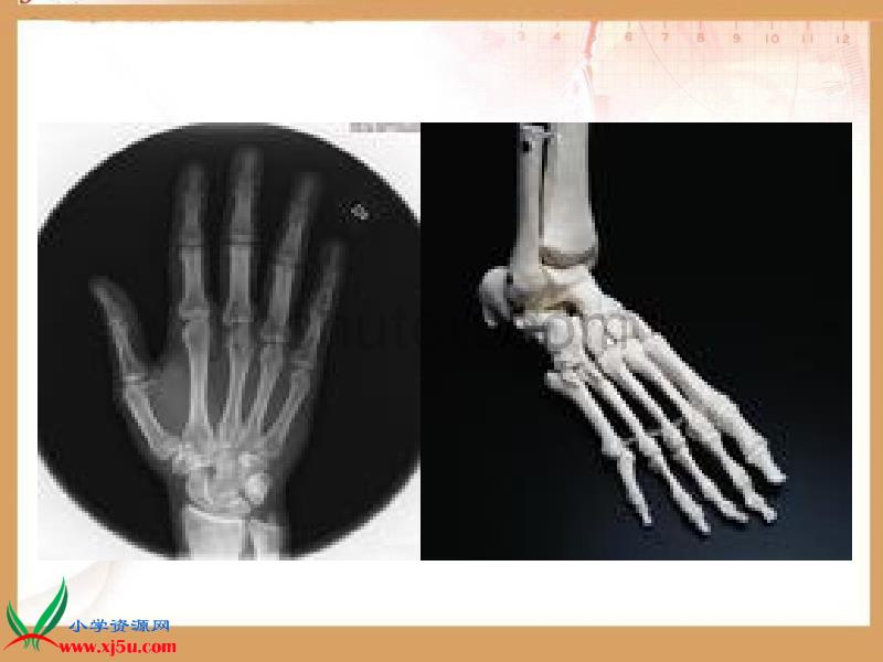 【苏教版】四年级科学下册课件骨骼4_第4页