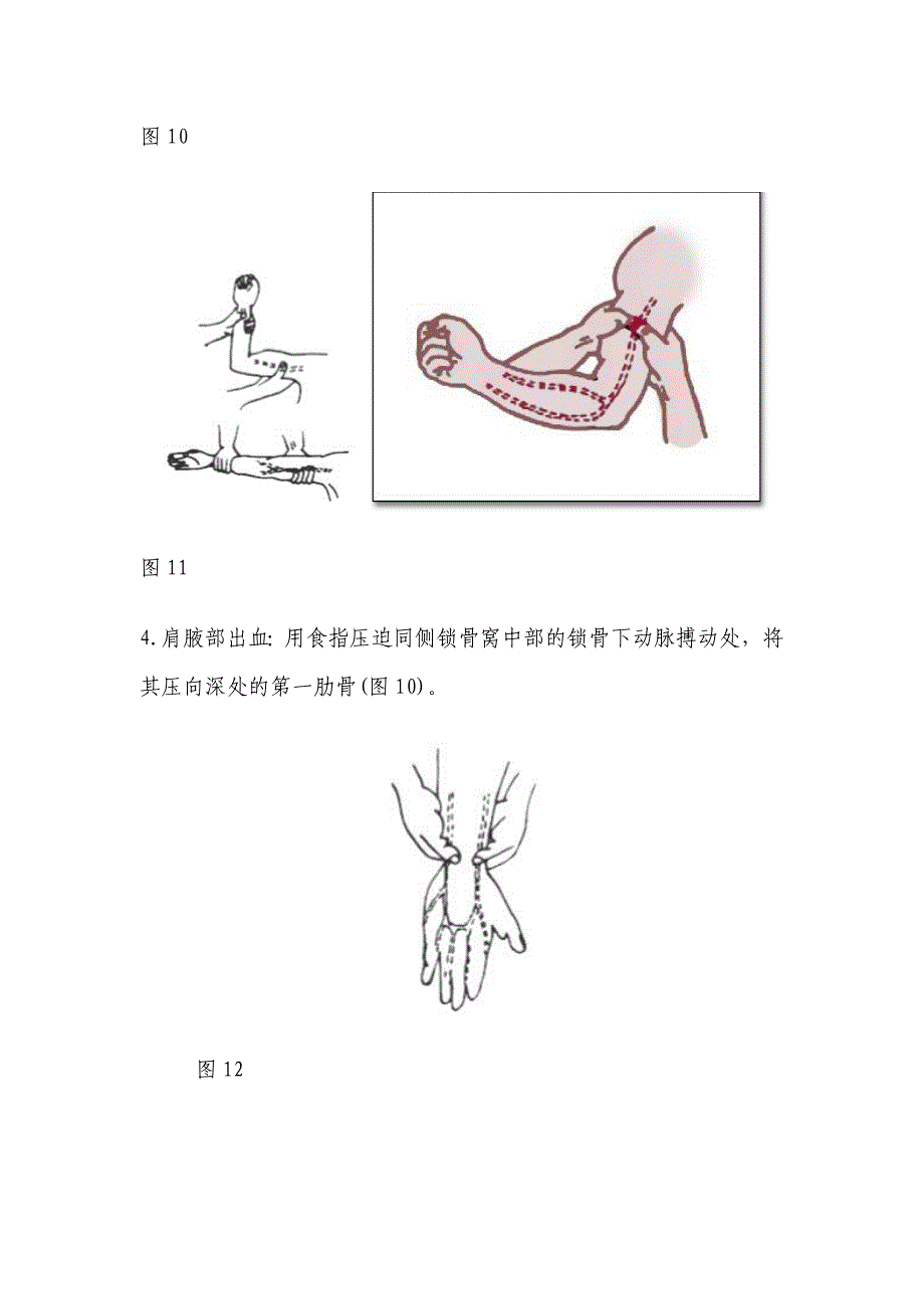 外伤出血急救_第4页