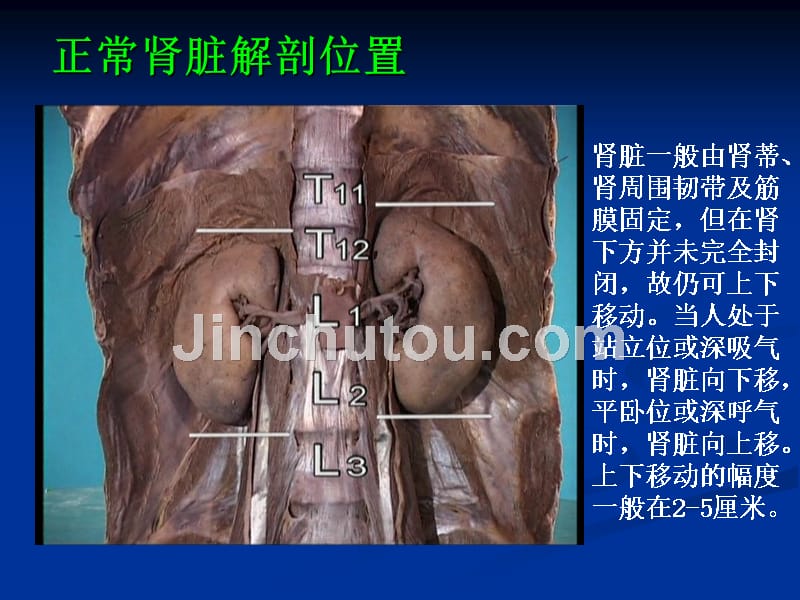 肾位置异常畸形_第3页