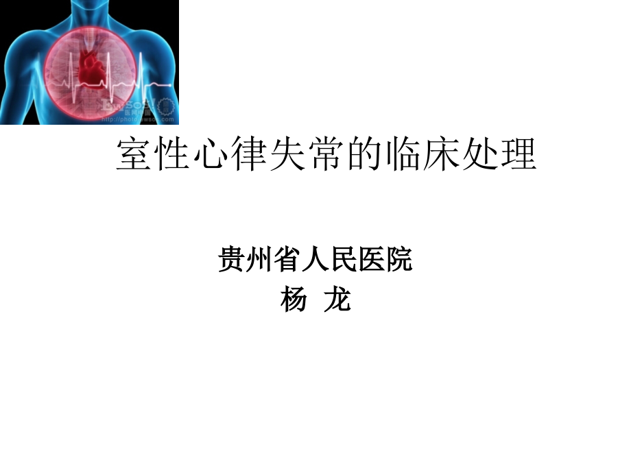 室性心律失常的临床处理原则课件_第1页