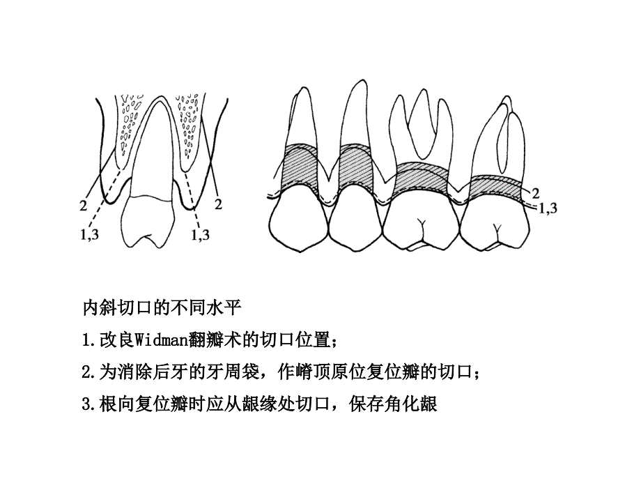 牙周病学第四版课件_第3页