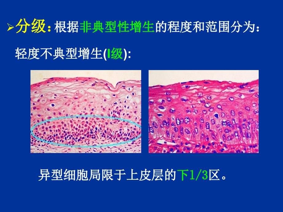 生殖系统和乳腺疾病小时课件_第5页