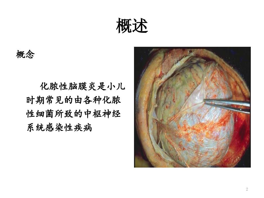 化脓性脑膜炎6课件_第2页