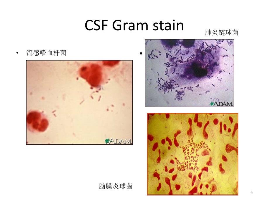 化脓性脑膜炎6课件_第4页