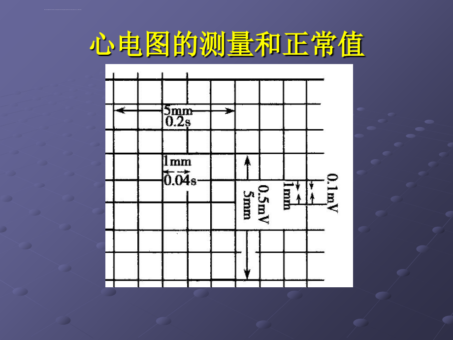 十二种心律失常课件_第4页