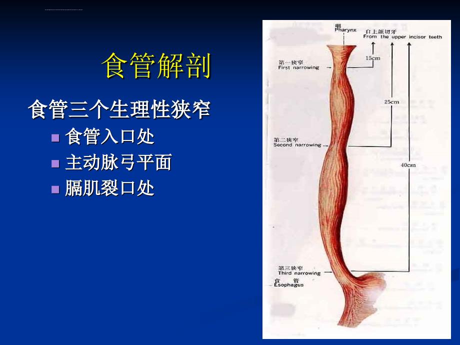 食管癌放疗患者护理课件_第4页