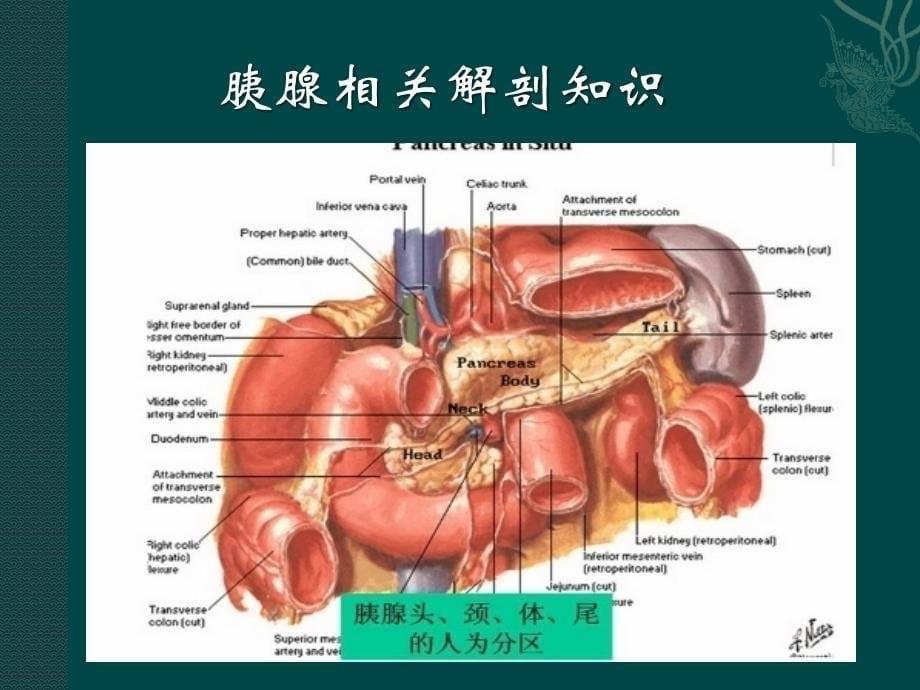 胰腺假性囊肿课件_第5页