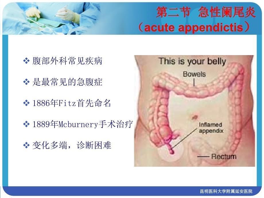 急性阑尾炎第八版课件_第5页