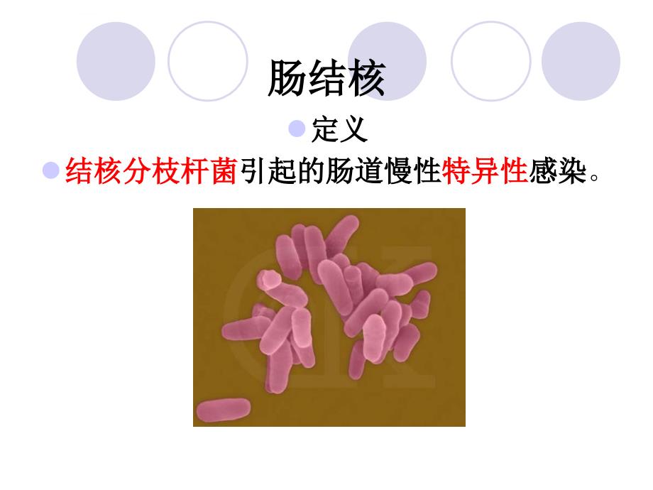 肠结核及结核性腹课件_第3页