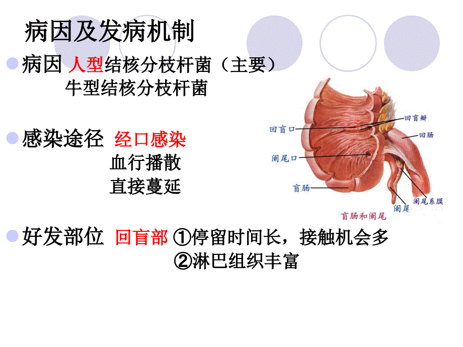 肠结核及结核性腹课件_第4页