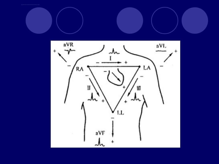 常见心电图识读课件_第5页