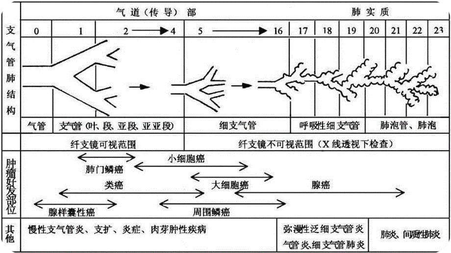 纤维支气管镜课件_第5页