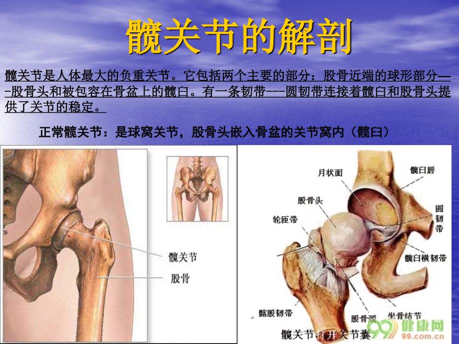 全髋关节置换教学查房课件_第3页