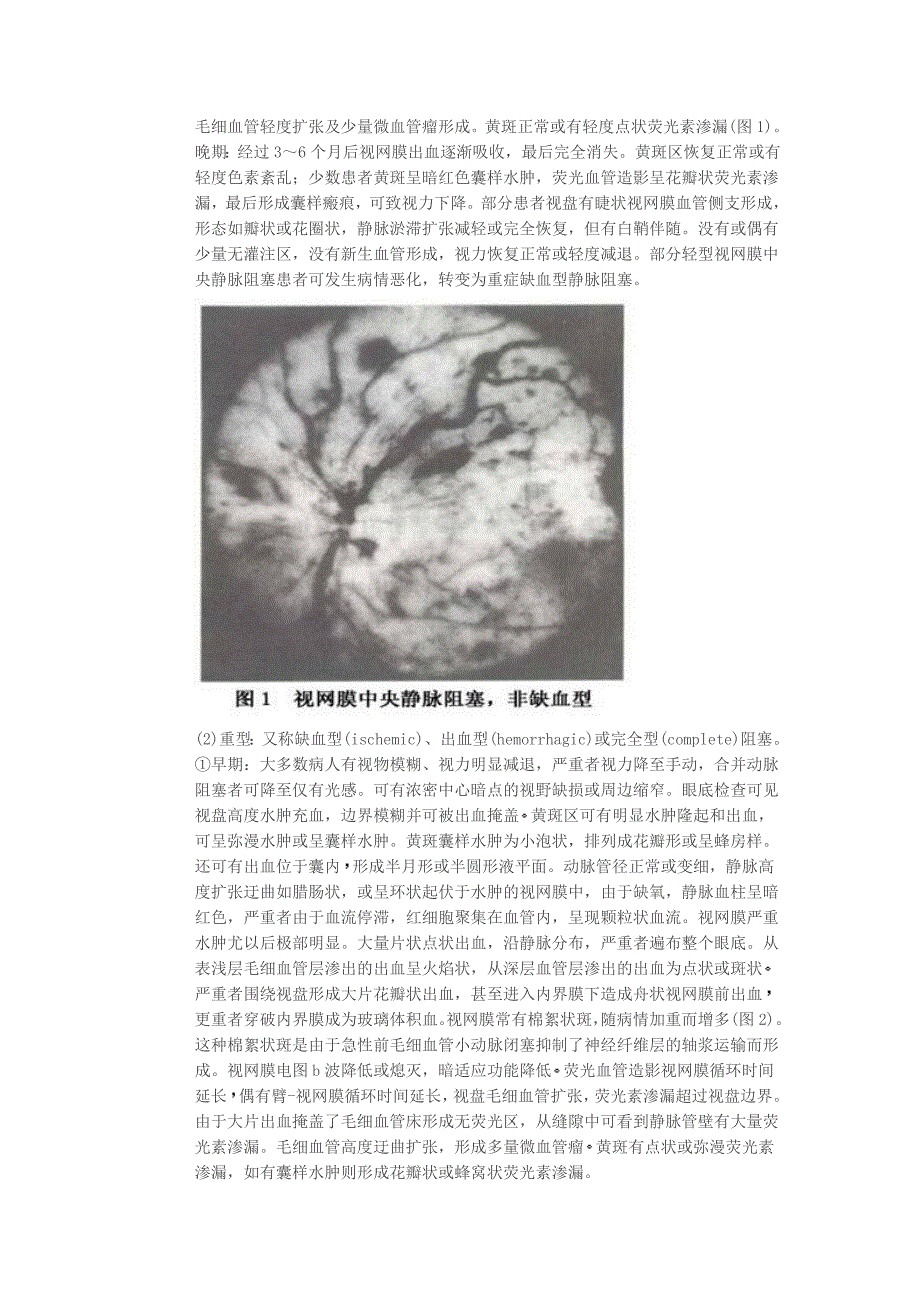 视网膜静脉阻塞_第3页