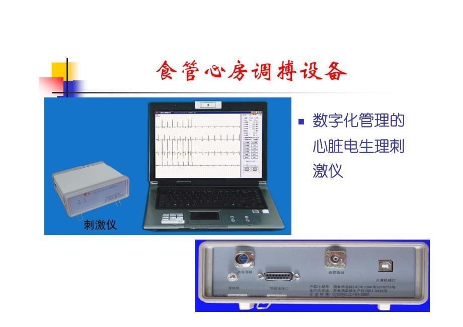 食管心房调搏方法学_第5页