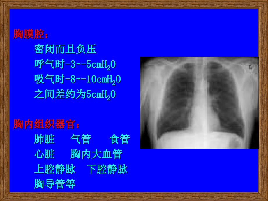 胸部损伤课件_第4页