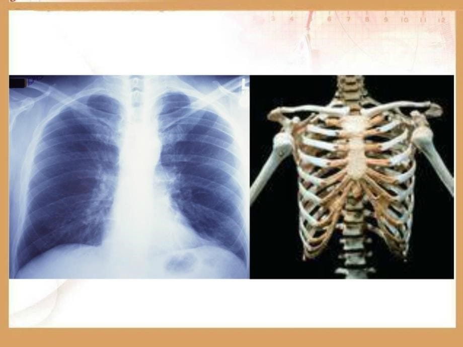 新版骨骼课件ppt下载苏教版四年级科学下册课件_第5页