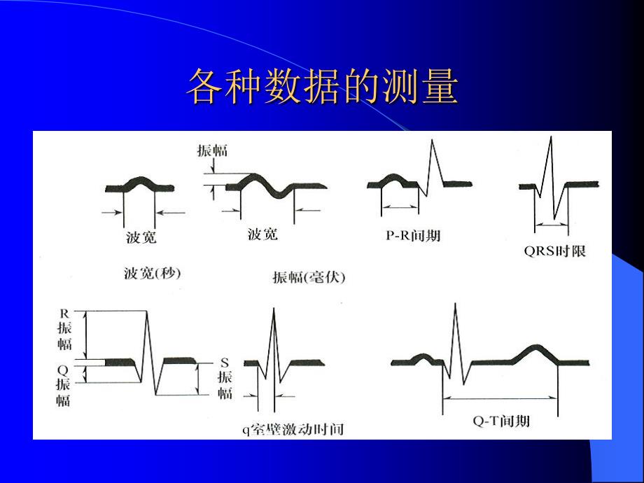 常见异常心电图知识_第3页