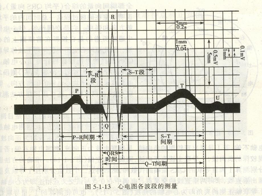 常见异常心电图知识_第4页