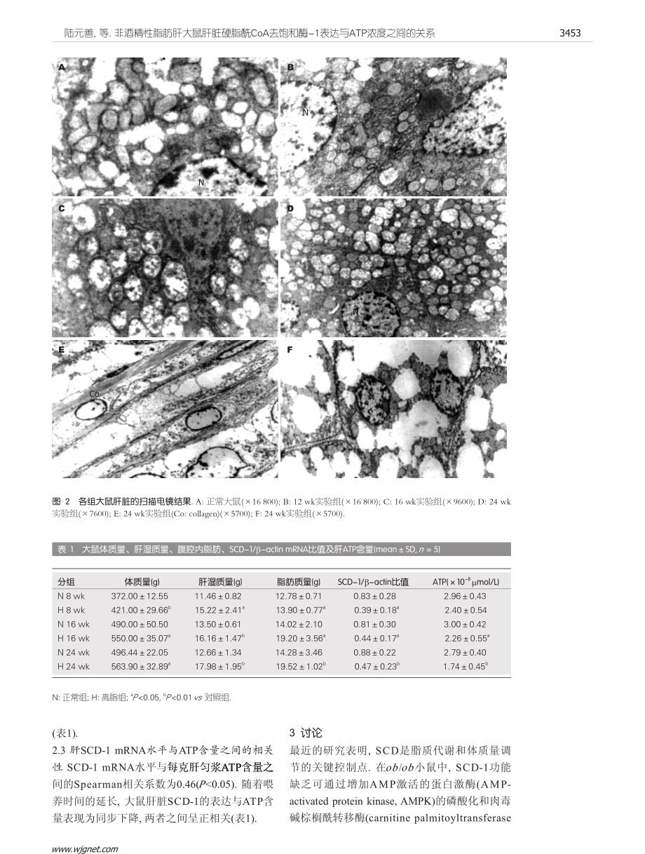 非酒精性脂肪肝大鼠肝脏硬脂酰coa去饱和酶-1表达与atp浓度之间的关系_第4页