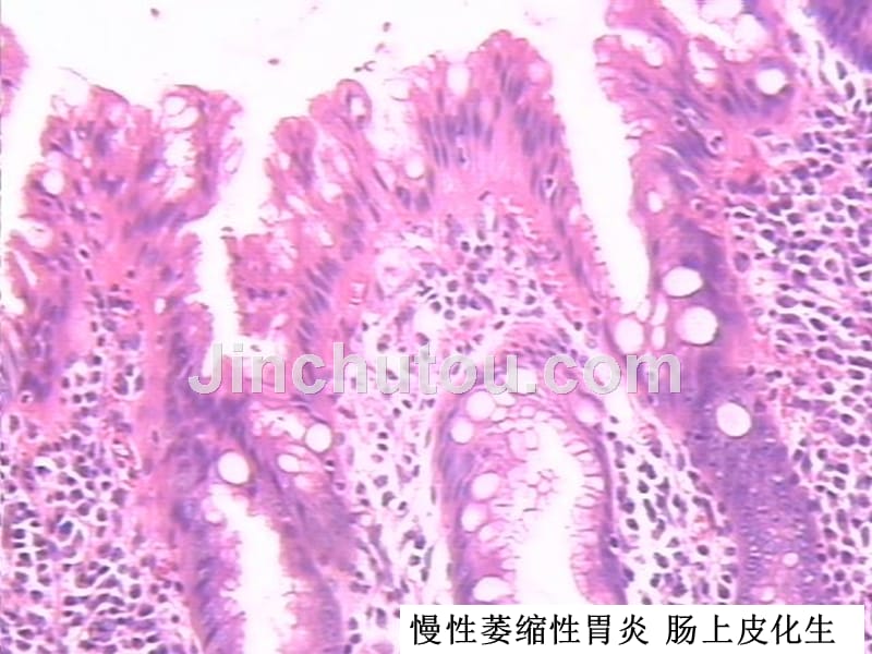 消化系统图片_第4页