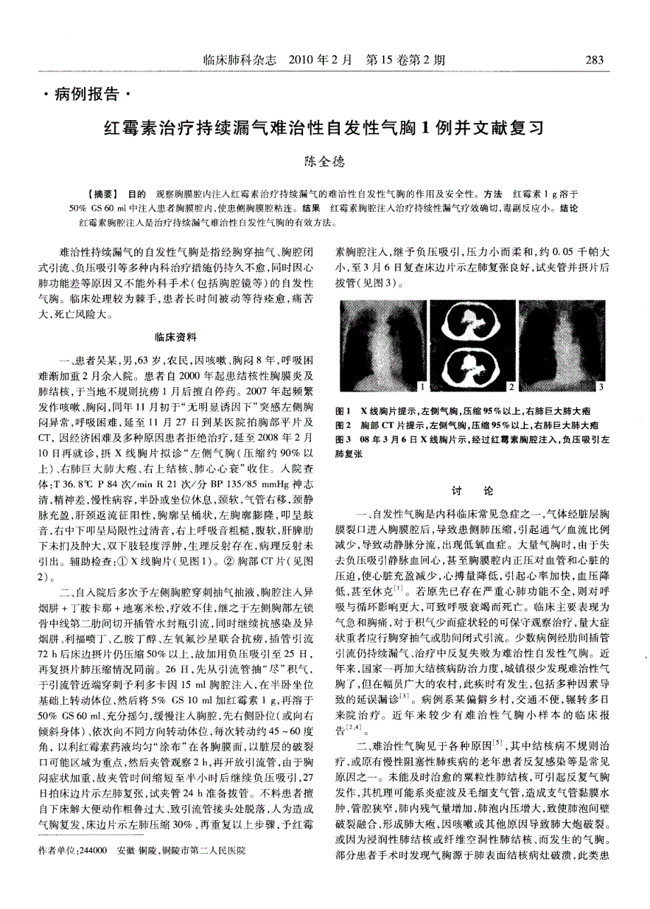 红霉素治疗持续漏气难治性自发性气胸1例并文献复习_第1页