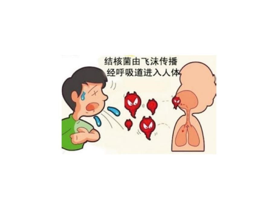 中班健康活动《感冒我不怕》剖析_第5页