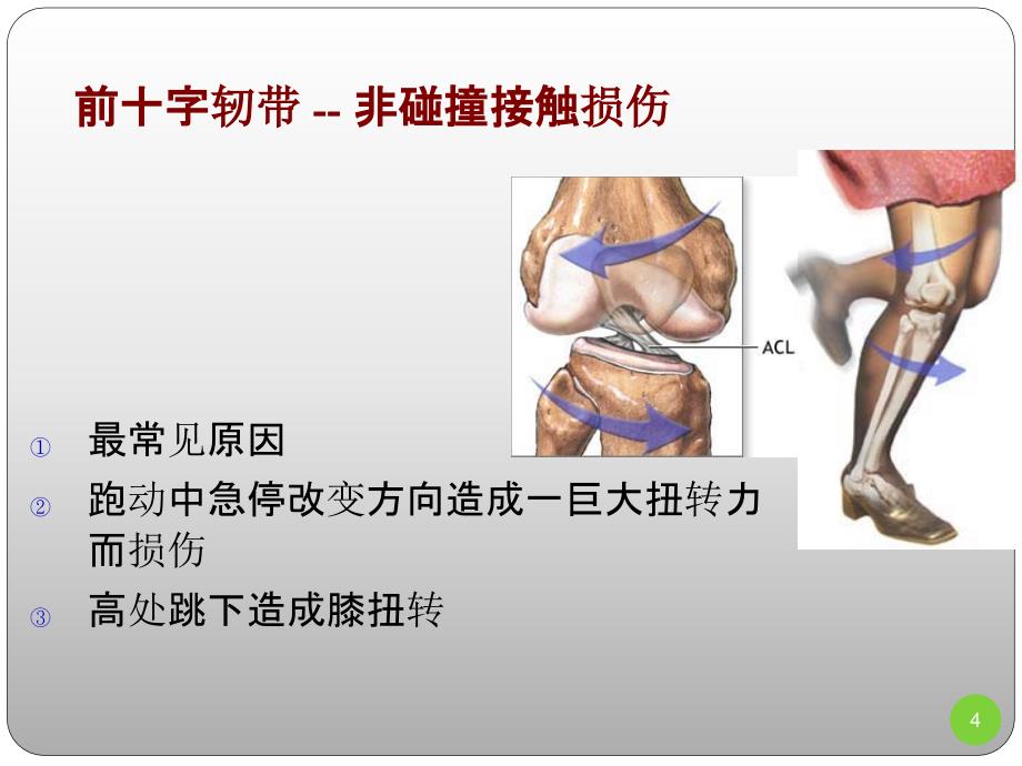 膝关节评估_9-17课件_第4页