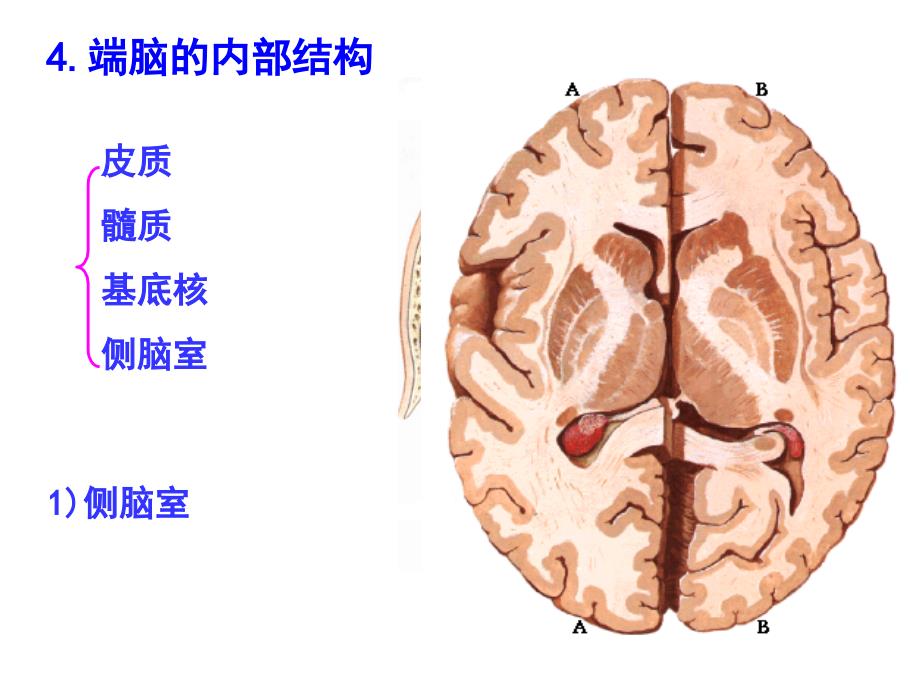 端脑、被膜、血管和脑脊液课程教案_第4页