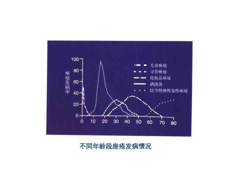 祛痘产品配方设计及其功效评价课件_第4页