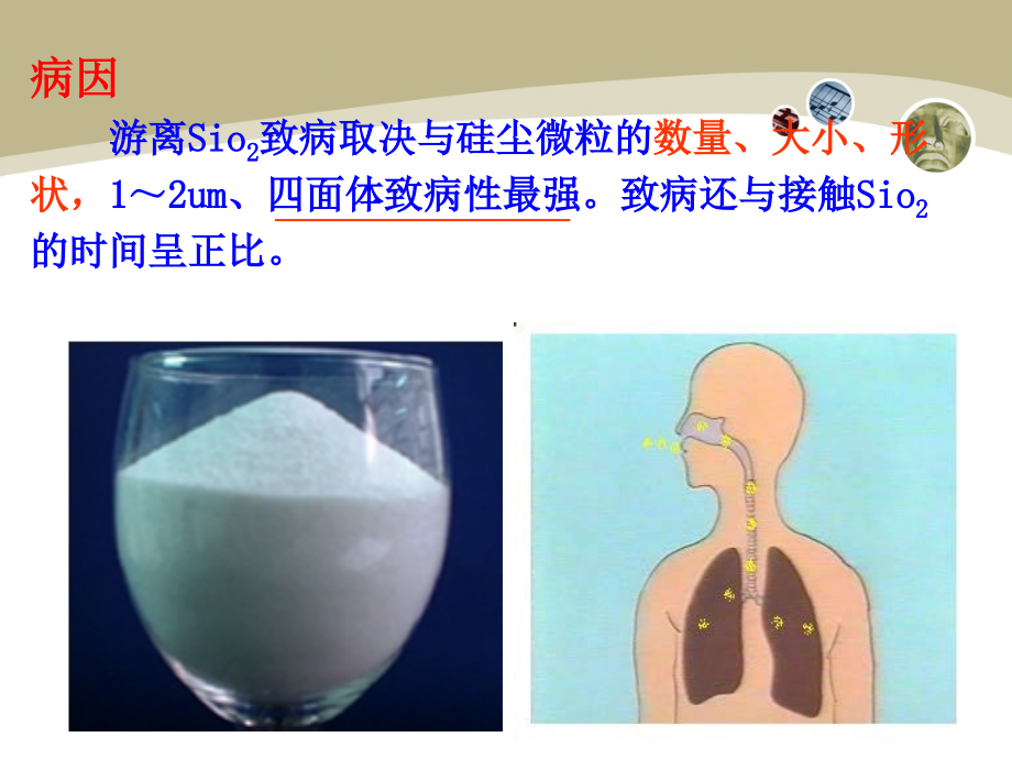 病理学矽肺、鼻咽癌、肺癌3_第4页