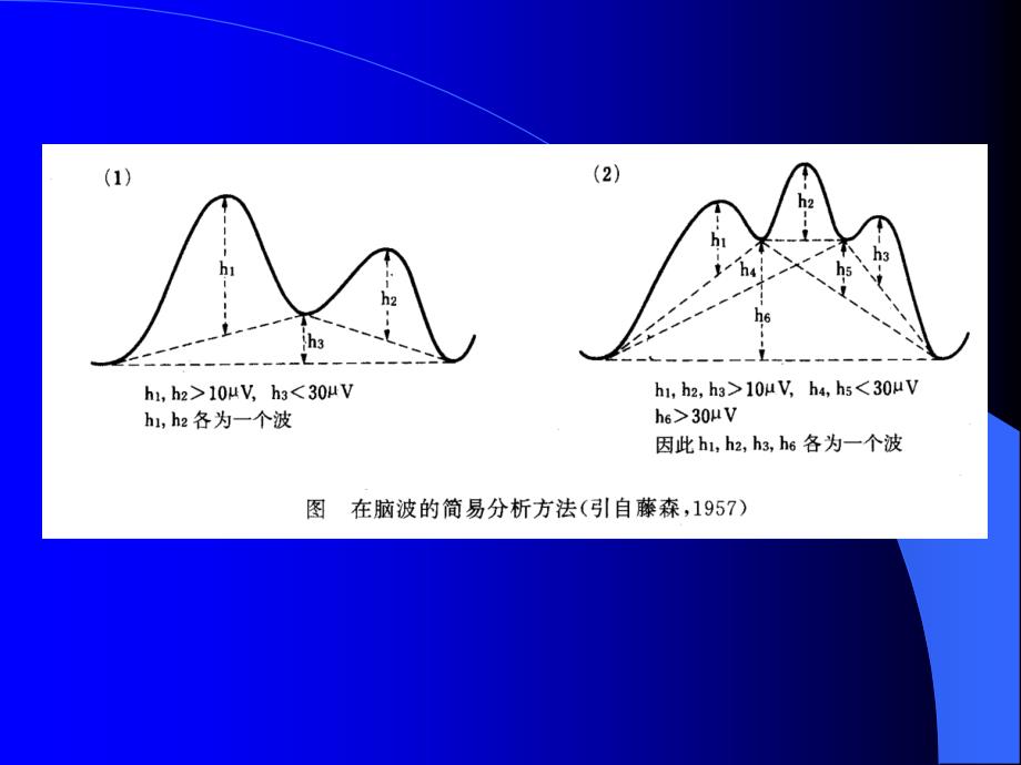 脑电图基本知识培训_第3页