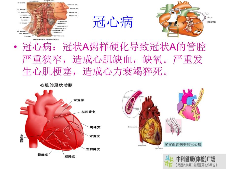 心脑血管疾病与“四高症”_第4页