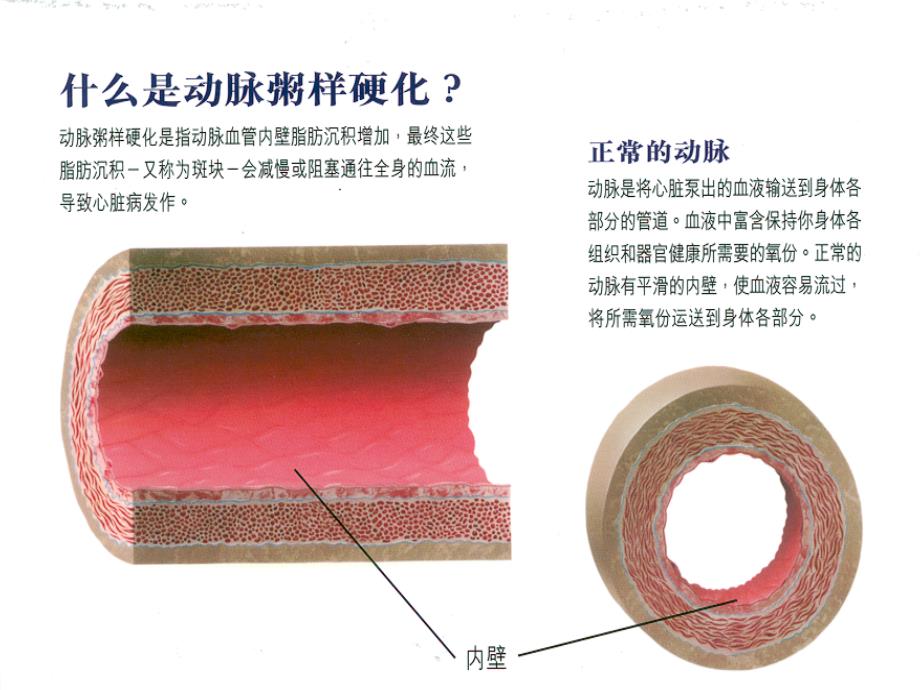 如何积极预防心脑血管疾病姜有志_第2页