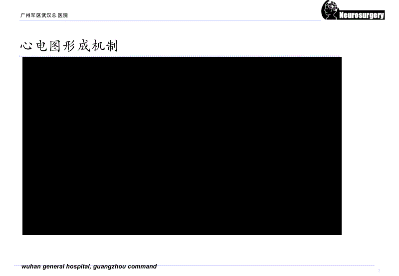 常见异常心电图(修改版)广州军区武汉总医院_第3页