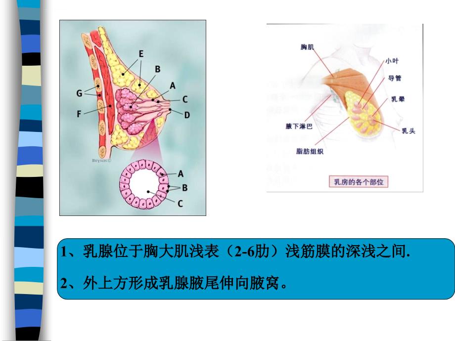 乳房疾病课件_第4页